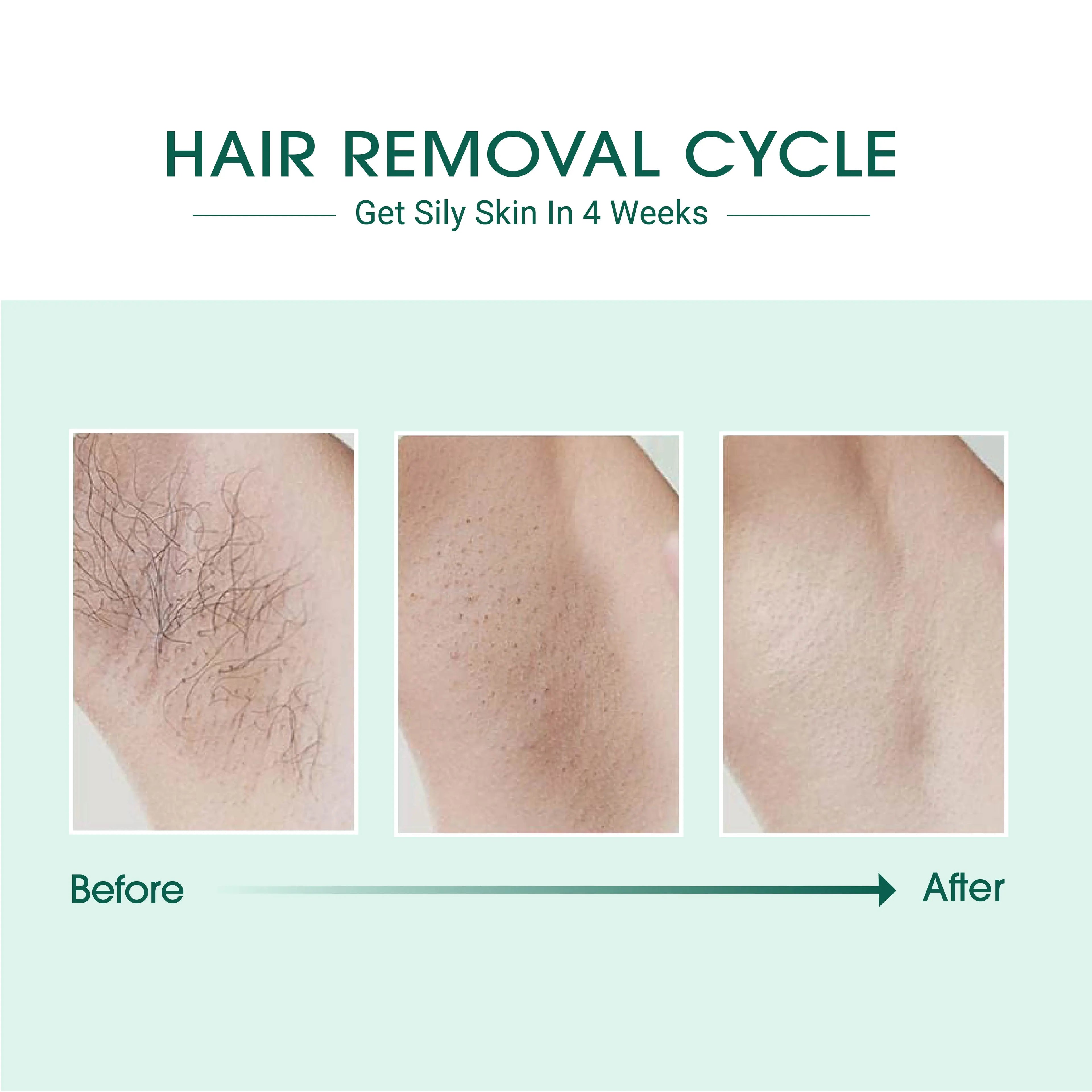 Laser IPL Hair Removal PrimeFinds
